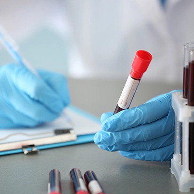 Forensic Drug Testing